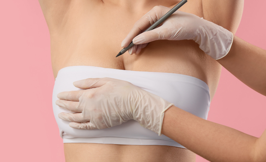 Reconstruyendo la esperanza: Innovación, fe y vida más allá del cáncer de mama
